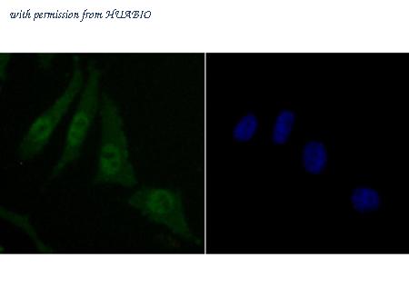 HUABIO ET1705-43 image 3