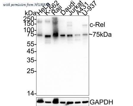 HUABIO ET1705-44 image 1
