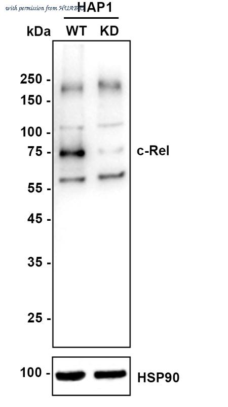 HUABIO ET1705-44 image 2