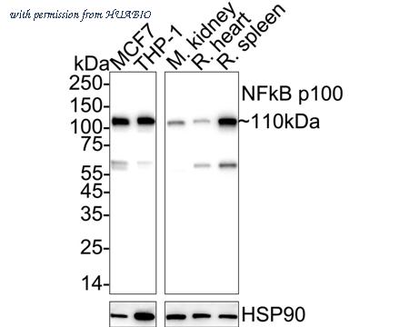 HUABIO ET1705-45 image 1