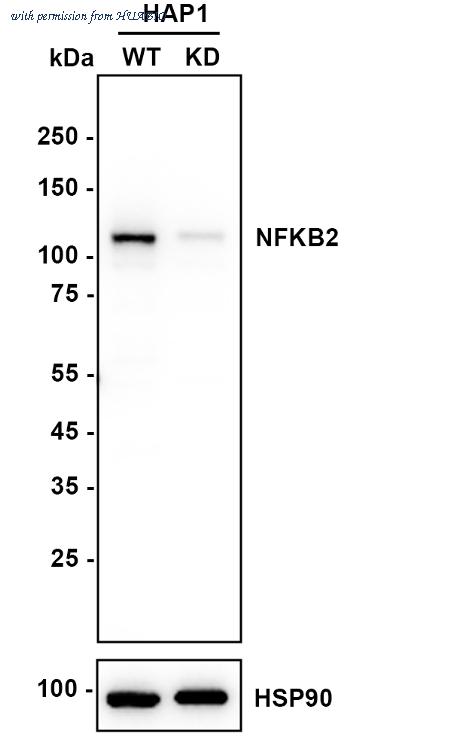 HUABIO ET1705-45 image 2
