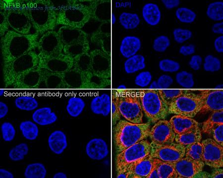HUABIO ET1705-45 image 3