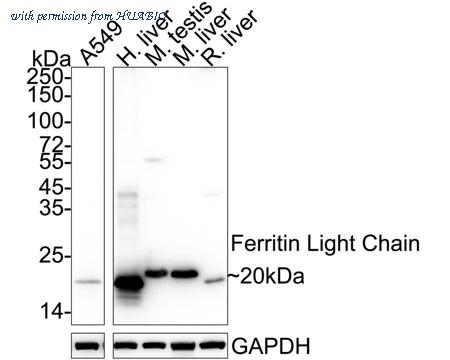 HUABIO ET1705-54 image 1