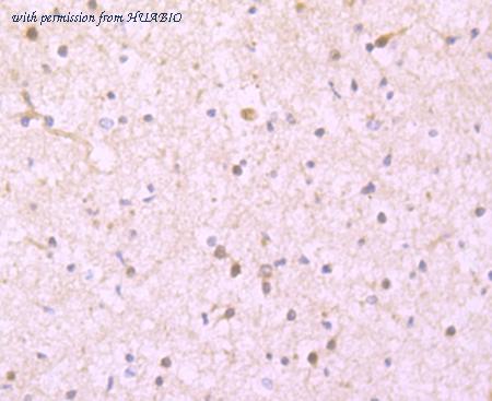 HUABIO ET1705-54 image 3