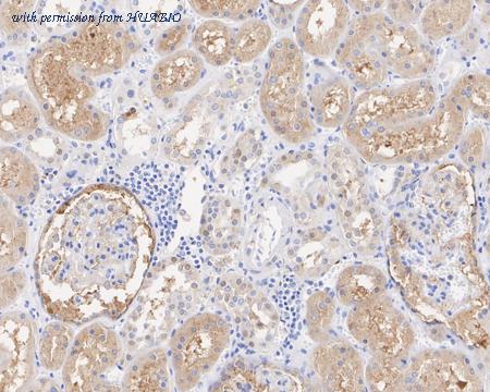 HUABIO ET1705-55 image 1