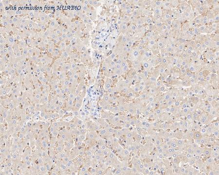 HUABIO ET1705-55 image 2