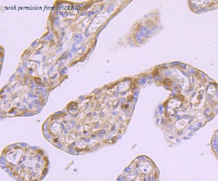 HUABIO ET1705-55 image 3