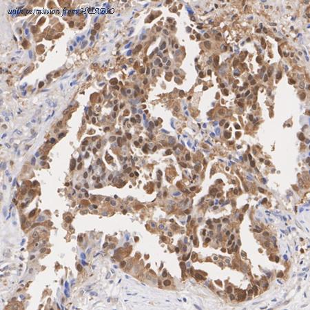 HUABIO ET1705-56 image 2