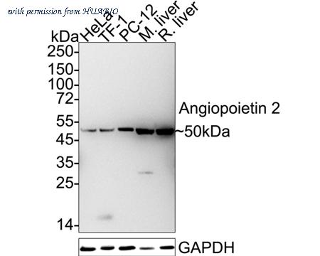 HUABIO ET1705-6 image 1