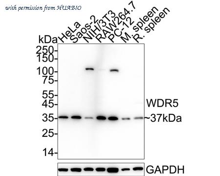 HUABIO ET1705-60 image 1