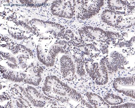 HUABIO ET1705-60 image 3