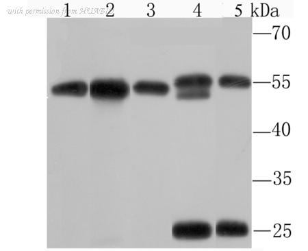 HUABIO ET1705-61 image 1