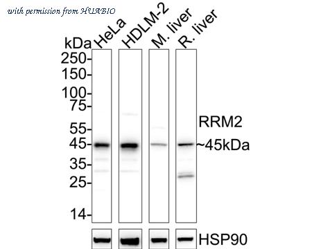 HUABIO ET1705-62 image 1