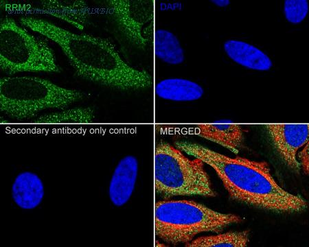 HUABIO ET1705-62 image 2