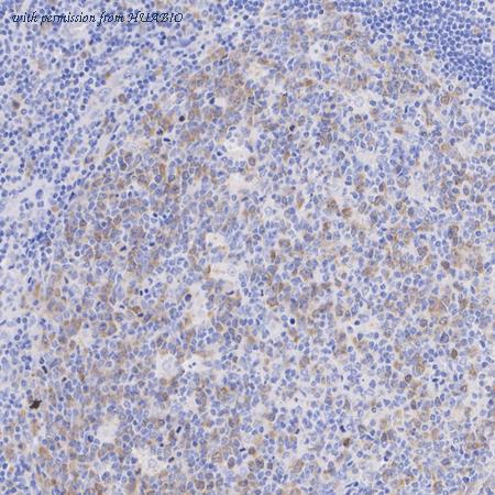 HUABIO ET1705-62 image 3