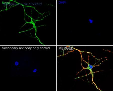 HUABIO ET1705-63 image 1