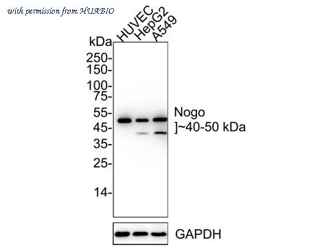 HUABIO ET1705-63 image 2