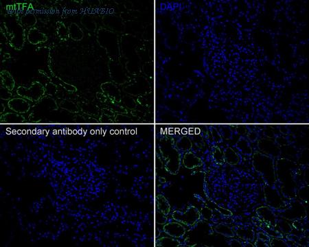 HUABIO ET1705-64 image 2