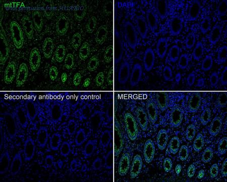HUABIO ET1705-64 image 3