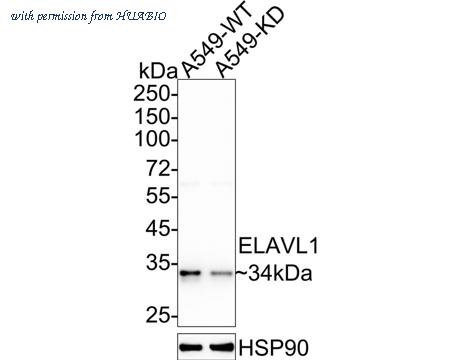 HUABIO ET1705-81 image 1
