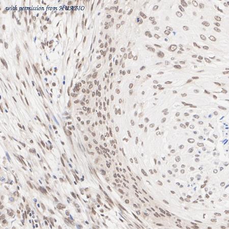 HUABIO ET1705-81 image 3