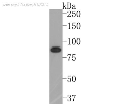 HUABIO ET1705-82 image 1