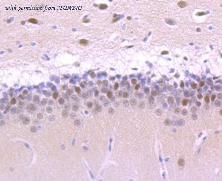 HUABIO ET1705-82 image 2