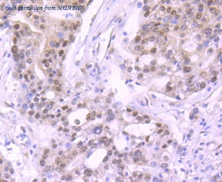 HUABIO ET1705-82 image 3