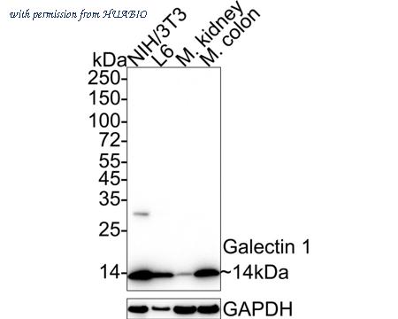 HUABIO ET1705-83-50UL image 2