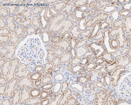 HUABIO ET1705-84-50UL image 3