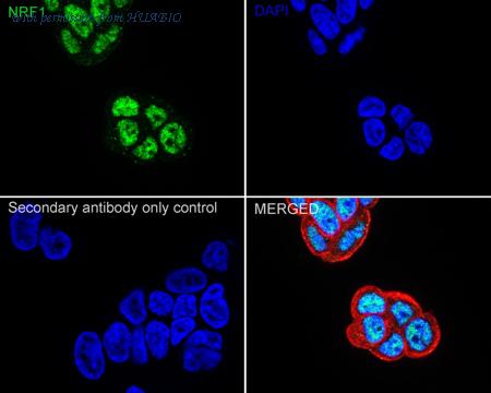 HUABIO ET1705-86-50UL image 3