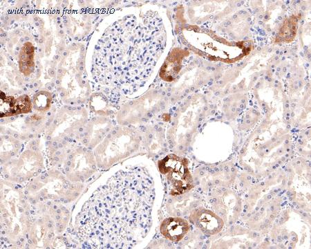 HUABIO ET1705-88-50UL image 3