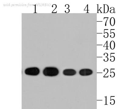 HUABIO ET1706-08-50UL image 1