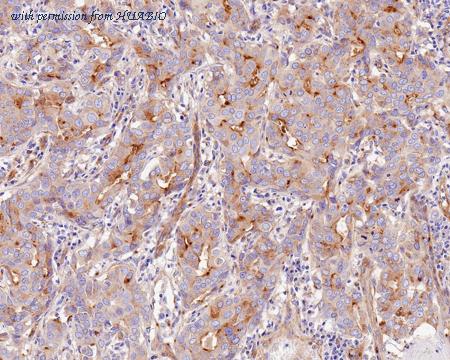 HUABIO ET1706-09 image 3