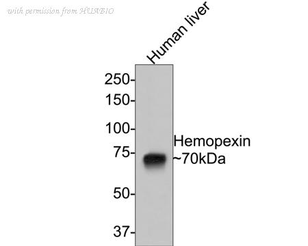 HUABIO ET1706-10 image 1