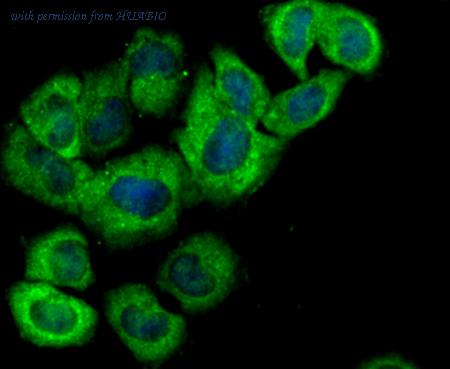 HUABIO ET1706-10 image 3