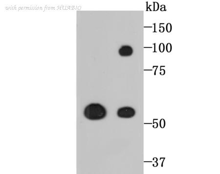 HUABIO ET1706-11 image 1