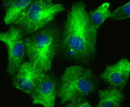 HUABIO ET1706-11 image 3