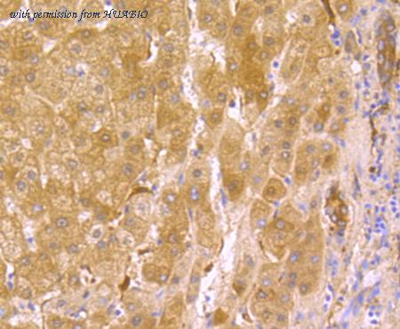 HUABIO ET1706-12 image 3