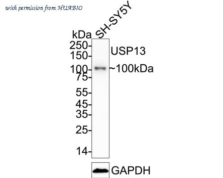 HUABIO ET1706-14 image 1