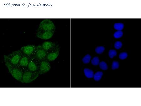 HUABIO ET1706-15 image 2