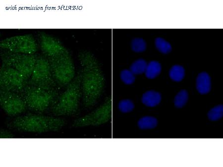 HUABIO ET1706-15 image 3