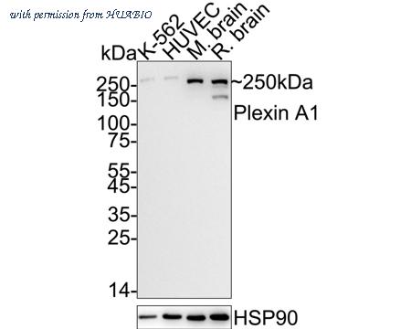 HUABIO ET1706-17 image 1
