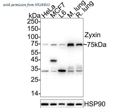 HUABIO ET1706-18 image 1