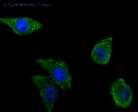 HUABIO ET1706-18 image 3