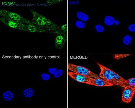 HUABIO ET1706-19 image 3