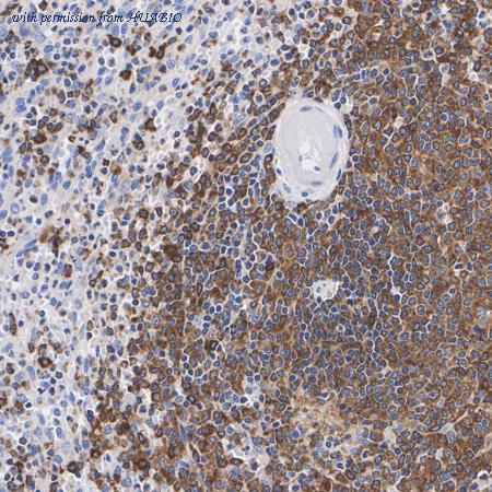 HUABIO ET1706-20 image 2