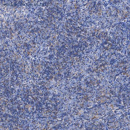 HUABIO ET1706-20 image 3