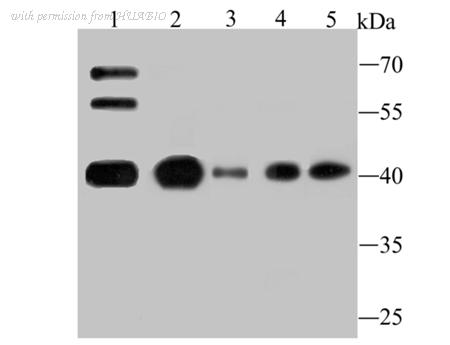 HUABIO ET1706-29 image 1