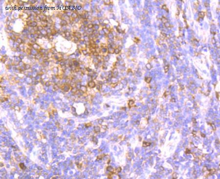 HUABIO ET1706-29 image 2